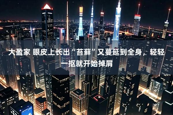 大盈家 眼皮上长出“苔藓”又蔓延到全身，轻轻一抠就开始掉屑